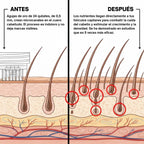 TorvoRevive™ Sistema de Crecimiento Capilar