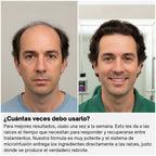 TorvoRevive™ Sistema de Crecimiento Capilar