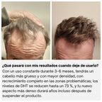 TorvoRevive™ Sistema de Crecimiento Capilar